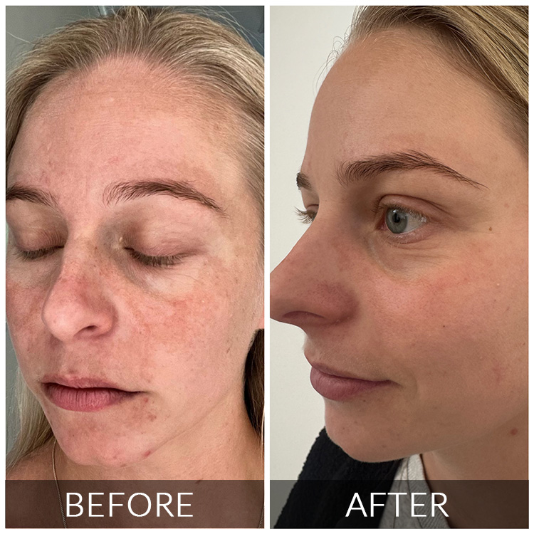 https://silk.theagencydev.co.za/wp-content/uploads/2026/08/BEFORE-AFTER-1.jpg