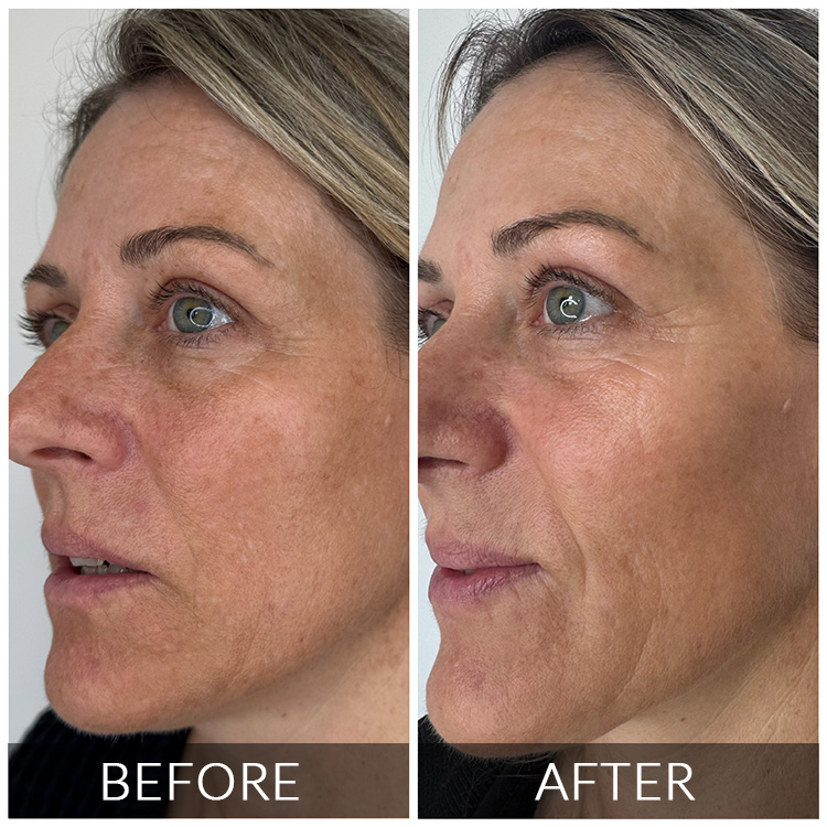 https://silk.theagencydev.co.za/wp-content/uploads/2026/08/BEFORE-AFTER-2.jpg