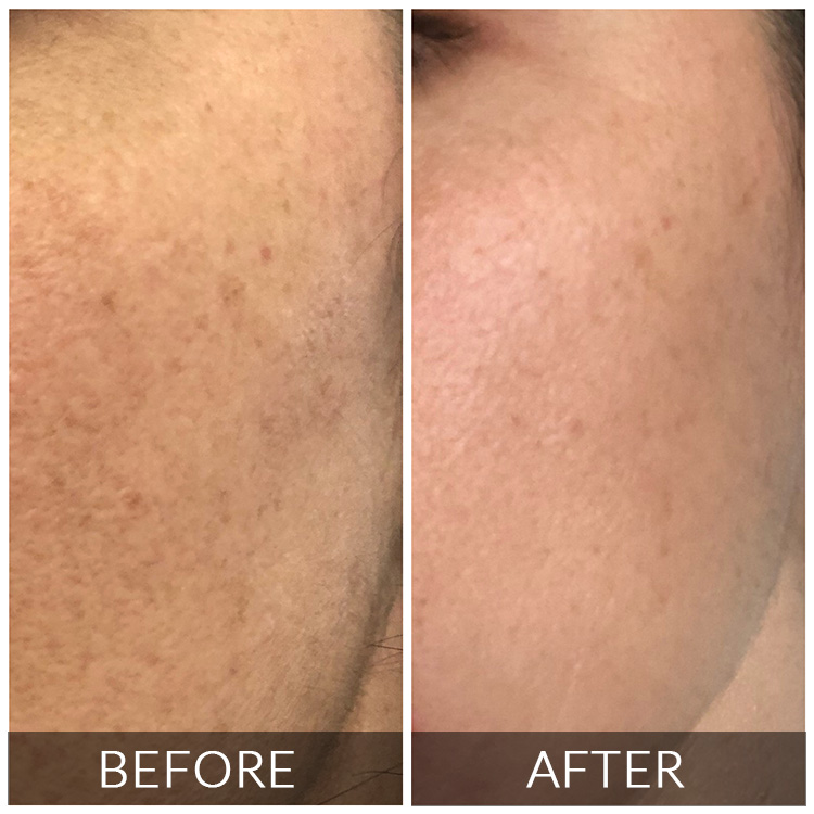 https://silk.theagencydev.co.za/wp-content/uploads/2026/08/BEFORE-AFTER-3.jpg