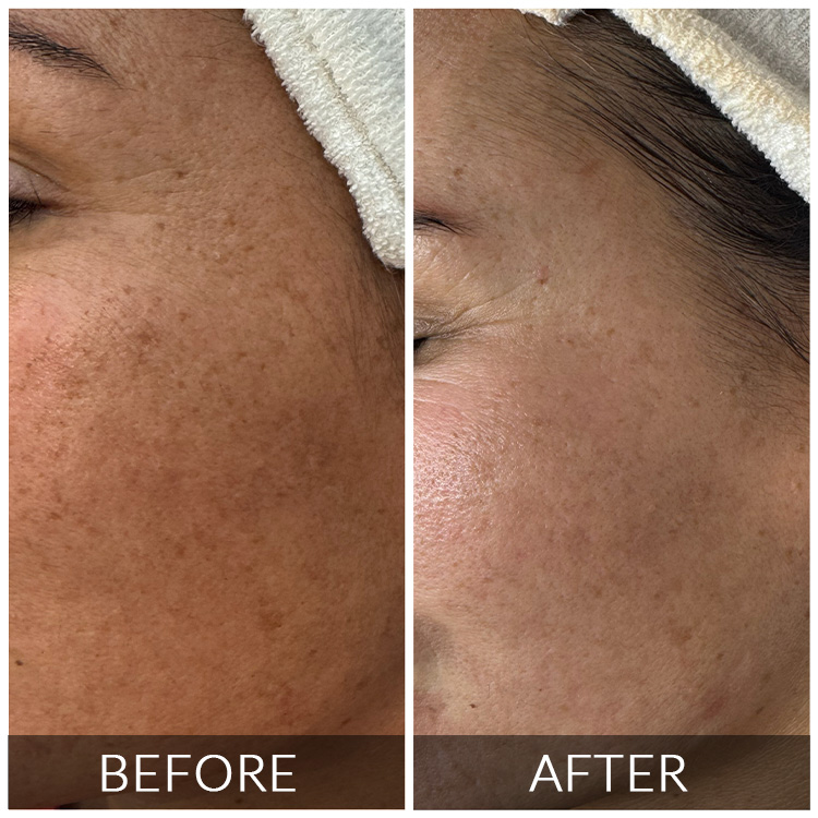 https://silk.theagencydev.co.za/wp-content/uploads/2026/08/BEFORE-AFTER-4.jpg