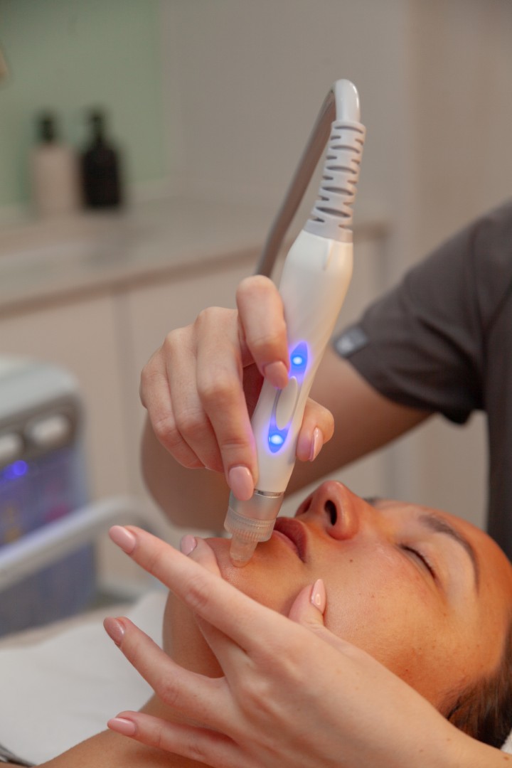 Women relaxing and getting a hydrodermabrasion treatment